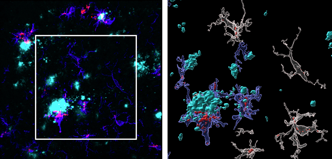 TSPO in neuron