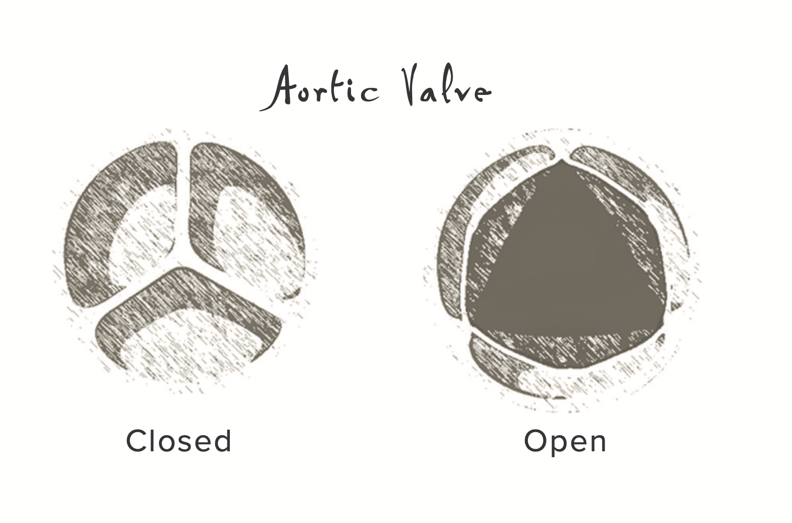 heart valves